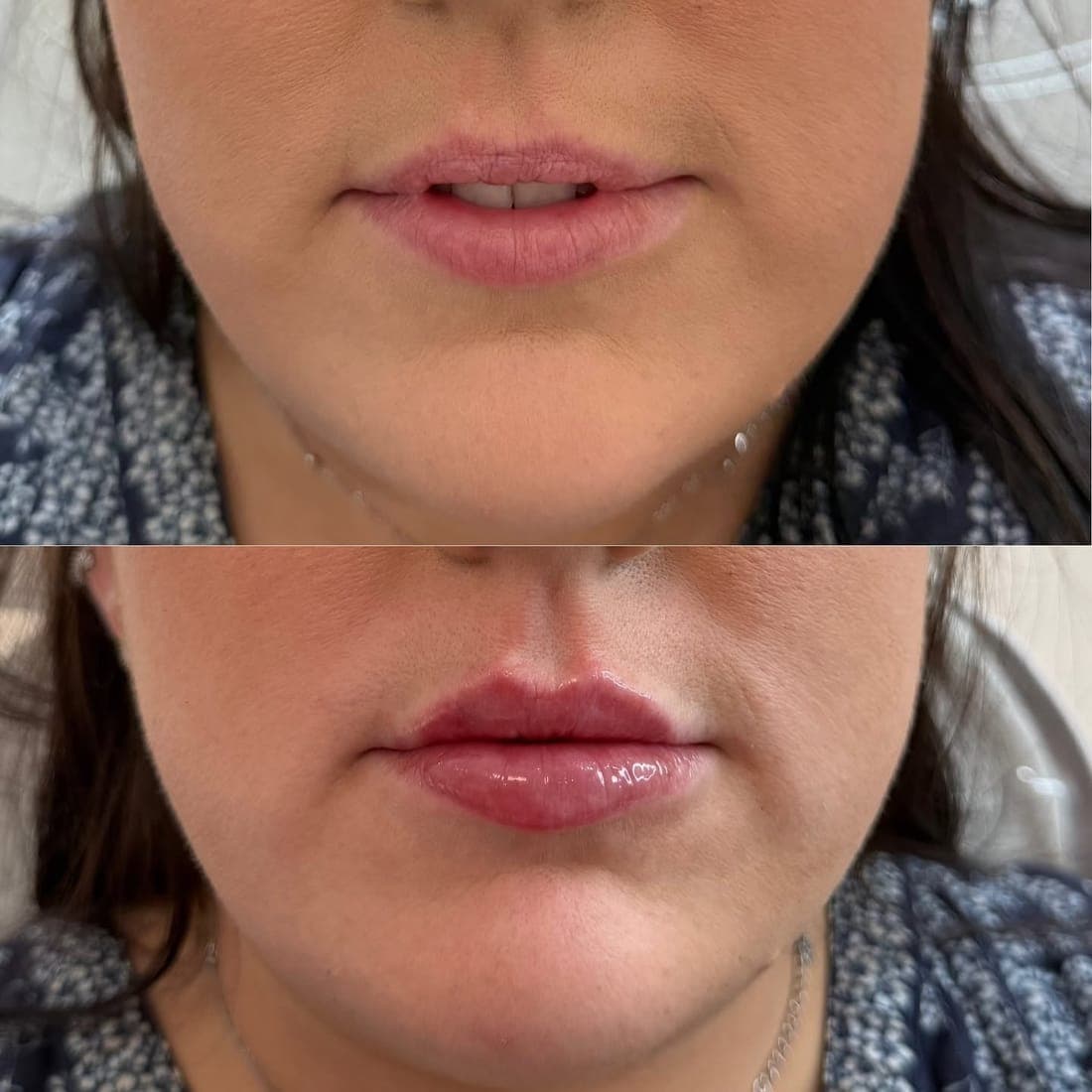 Lips close up, before above and after below
