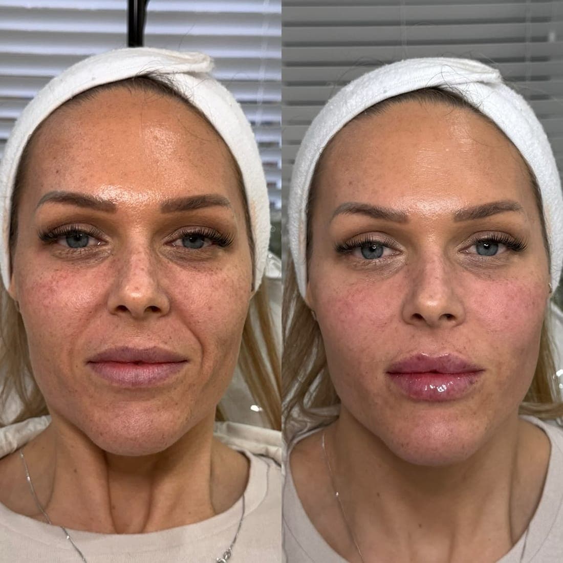 Full face before and after, side by side, white headband