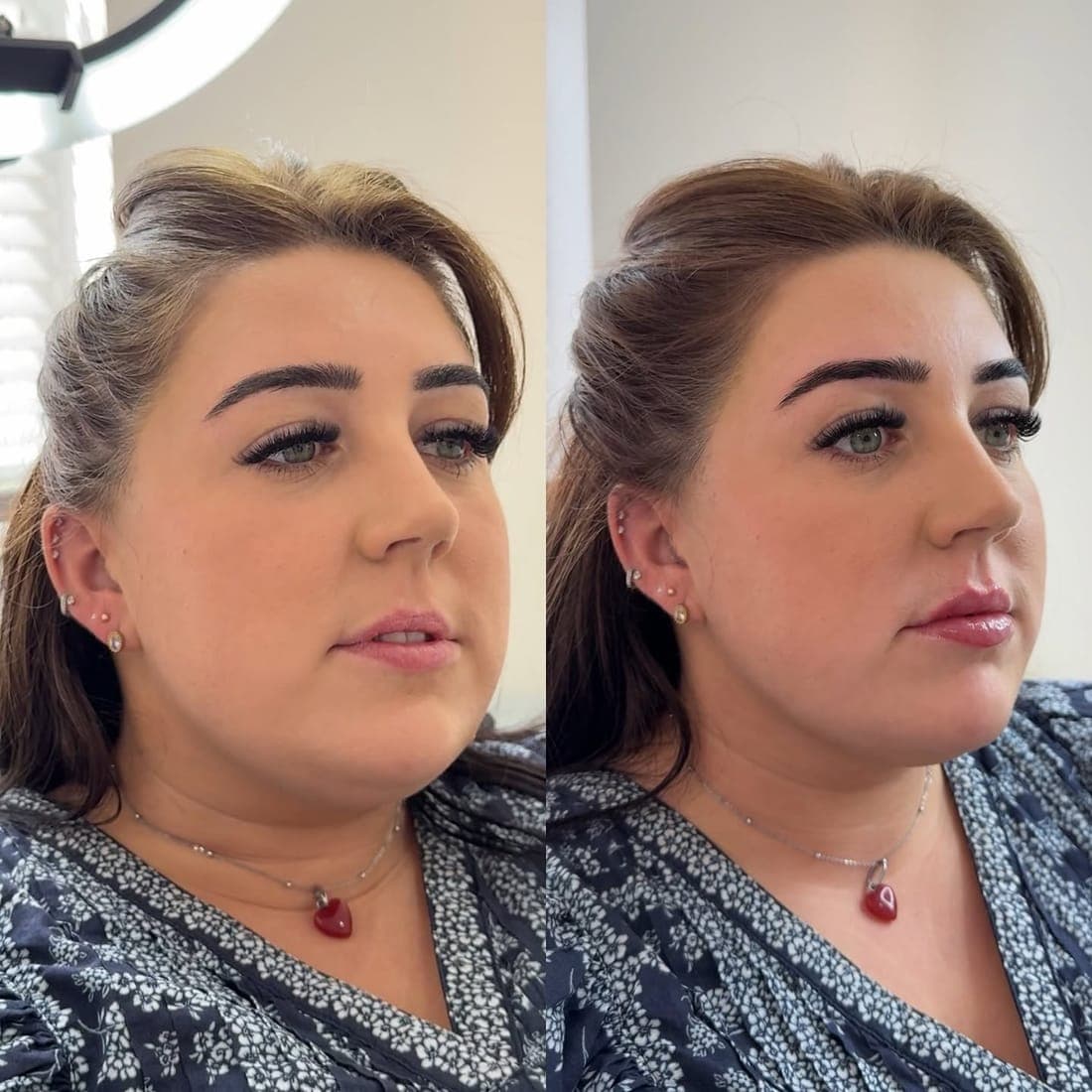 Face at three quarters, before and after side by side, patterned top
