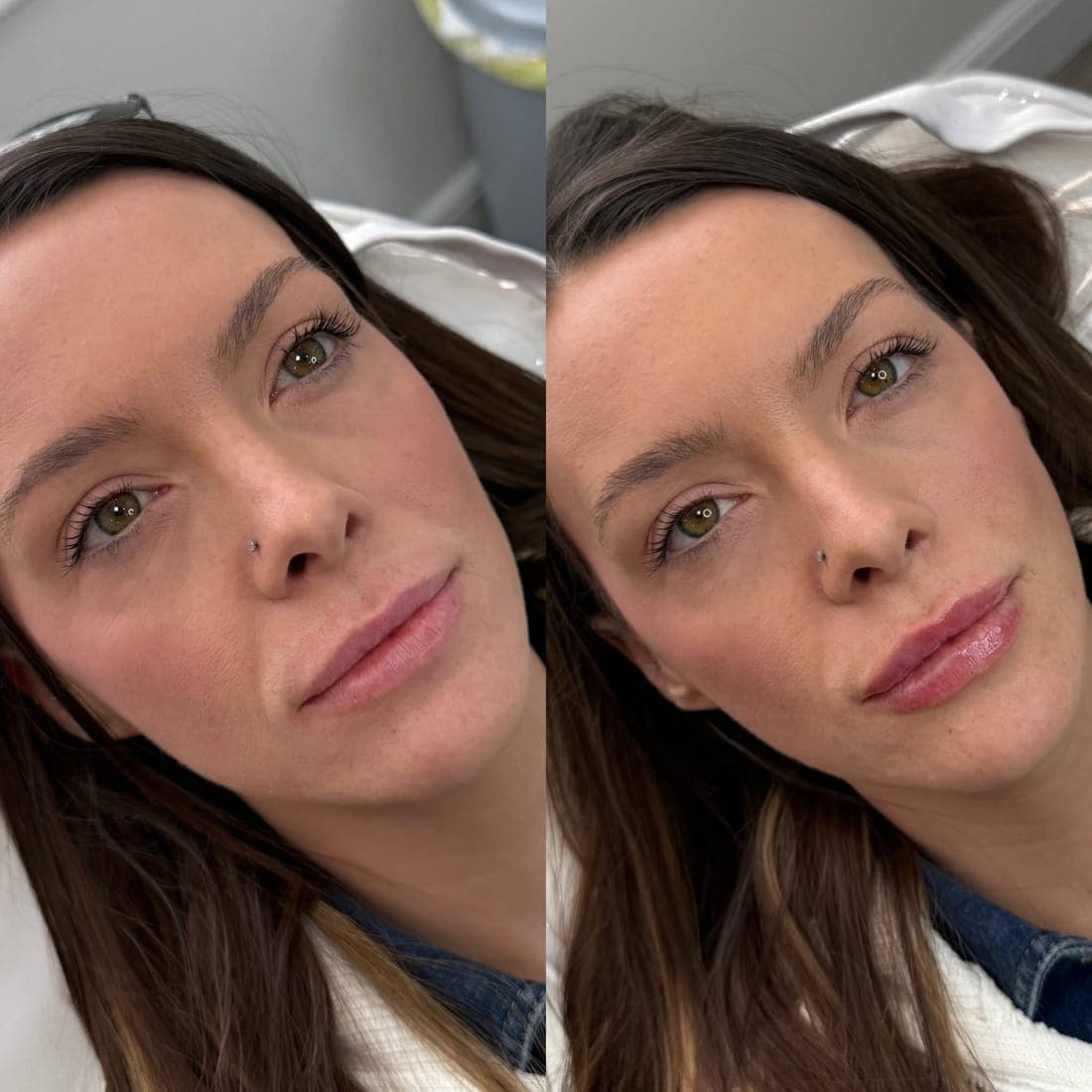 Face tilted, before and after side by side, dark hair