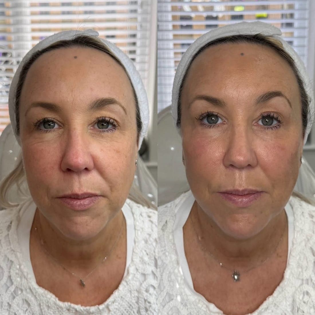 Full face before and after, side by side, white headband